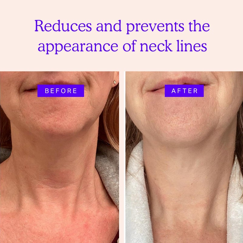BLUMBODY Neck Wrinkle Patches â€“ Anti-Wrinkle Silicone Patches for Skin Firming, Tightening â€“ Reusable Overnight Pads â€“ Anti-Aging Crepe Erase Pads â€“ Neck, DÃ©colletÃ© (1-Month Supply) - Image 2